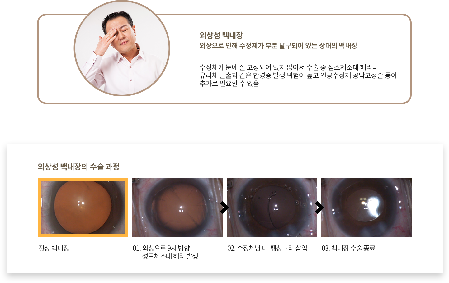 중증 당뇨 동반 백내장